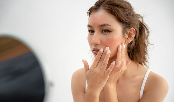 8 Ingredients to Look Out for If You Have Sensitive Skin